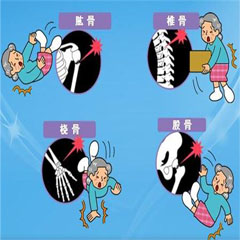 老年骨折“導(dǎo)火索”原來(lái)是骨密度