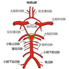 經(jīng)顱多普勒（TCD）可檢測的顱內(nèi)動脈大盤點(diǎn)！