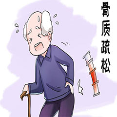 骨密度分析儀在檢查骨密度中有什么作用？