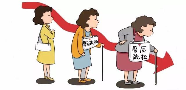 有這3個表現(xiàn)，一定要做骨密度檢測