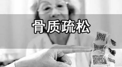 骨密度測(cè)量的時(shí)間和方法介紹