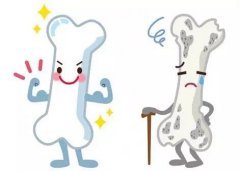 60歲阿姨骨密度為什么高？超聲骨密度儀廠家講解