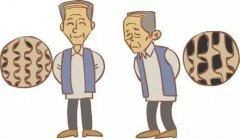 誰(shuí)是骨密度癥的高危人群