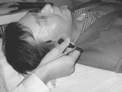 經(jīng)顱多普勒TCD顳窗透聲性差是為啥？